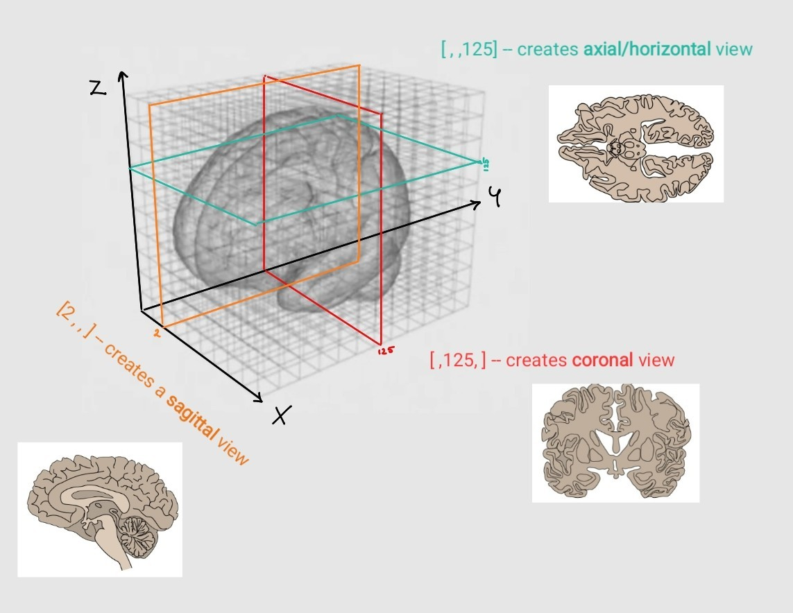 Figure 3. Visual representation about the different axes of the 3D arrays of NIfTI files. The axes are denoted in black. When we call these different slices we use a format like this: data [X, Y, Z]. If we want to include the whole width and height, we can just leave a comma at the place of X and Z. So, the red section represents the 125th slice along the Y axis (which is the axis of anterior-to-posterior), including its whole width and whole height (so represented as: [, 125 ,])