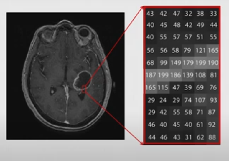 Figure 2. Voxels with assigned numbers corresponding to the highlighted area on an MRI axial scan of the brain. Note, that the areas appearing darker on the image have lower numbers, while areas that appear lighter have higher numbers.